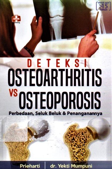 Cover Deteksi Osteoarthritis Vs Osteoporosis :  Perbedaan, Seluk Beluk dan Penangananya / Prieharti